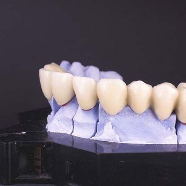 prótesis dentales  Valdepeñas