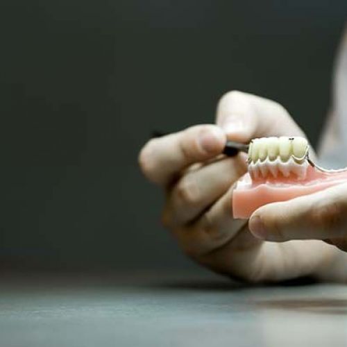 implantes dentales Valdepeñas
